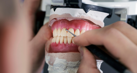 Cosmetic dental surgeries