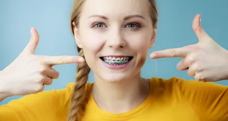 Dental Braces