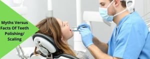 Myths Versus Facts Of Teeth Polishing Scaling Blogs