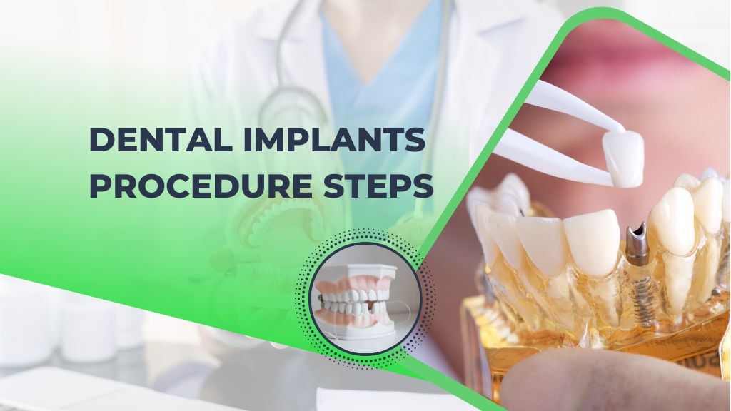 dental implants steps