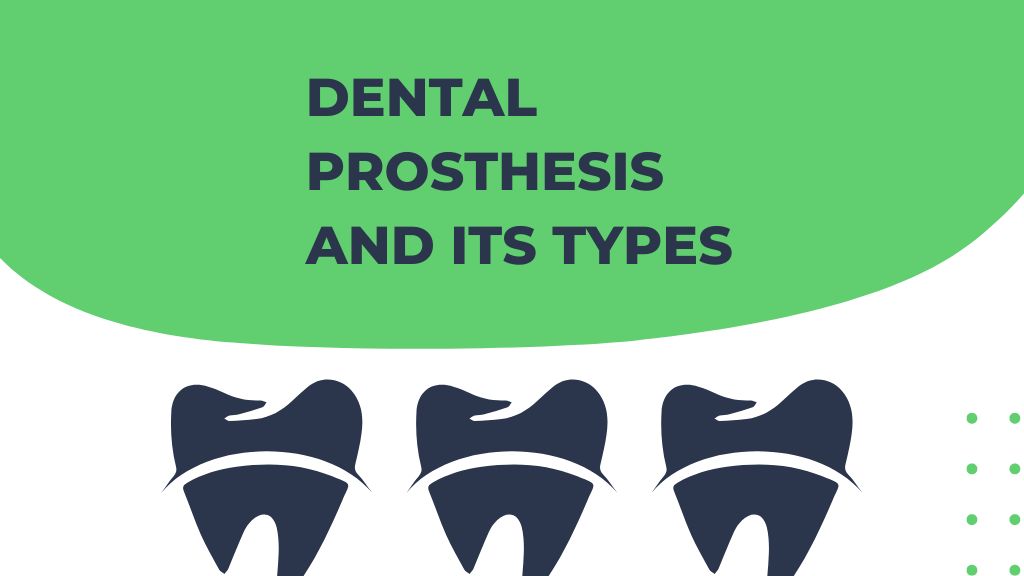 Dental Prosthesis and Its Types- banner