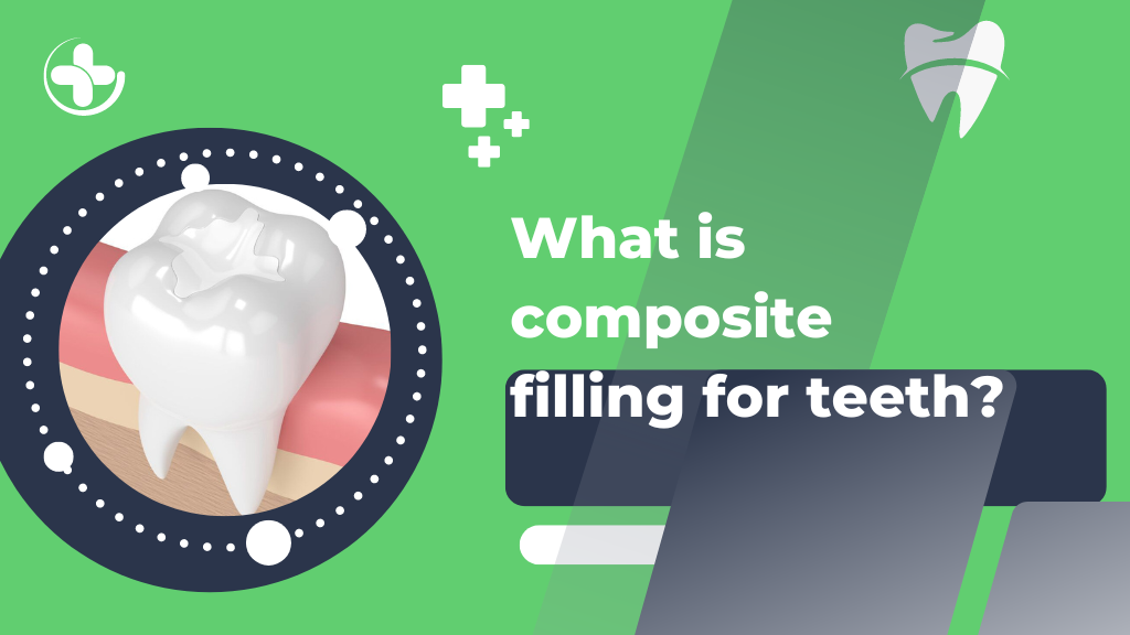 What is composite filling for teeth- BANNER