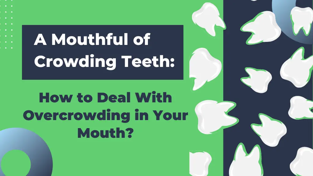 Crowding teeth- banner image