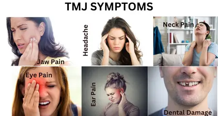 Temporomandibular joint disorder (TMD)