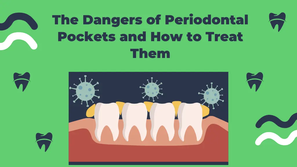 The Dangers of Periodontal Pockets and How to Treat Them